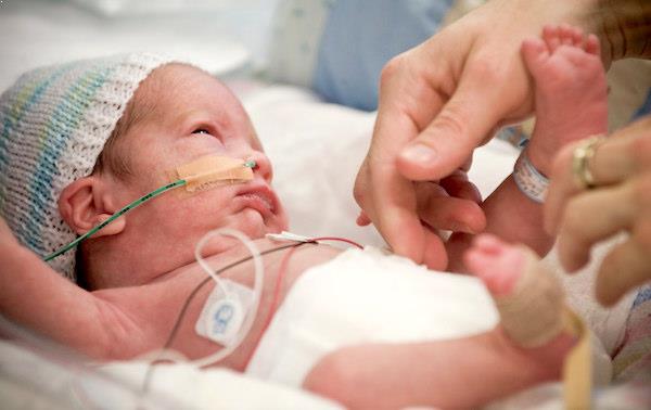 La mirada de un bebé prematuro / Babysitio