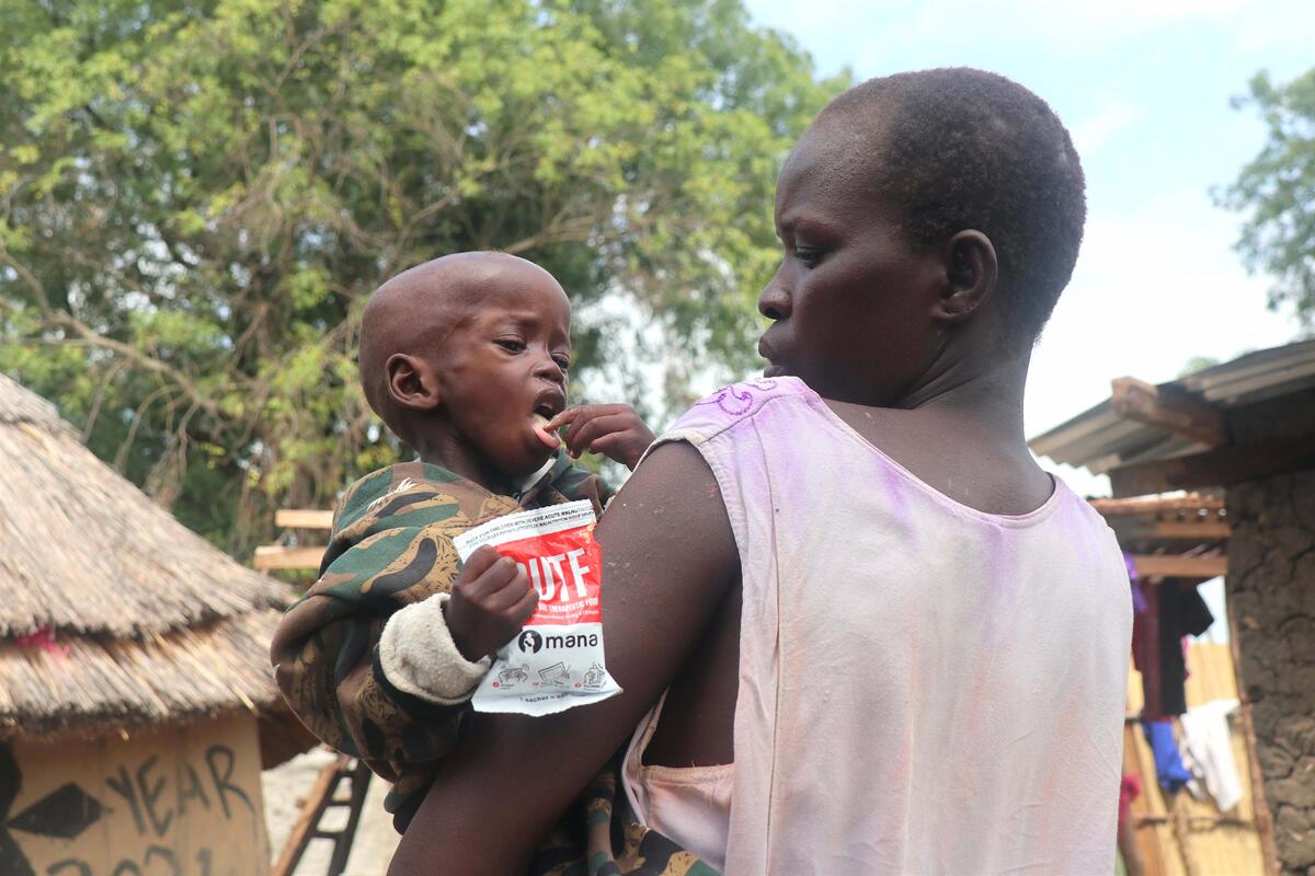 Más de 14 millones de niños sufren desnutrición por falta de alimentos desde el inicio de la pandemia / World Vision