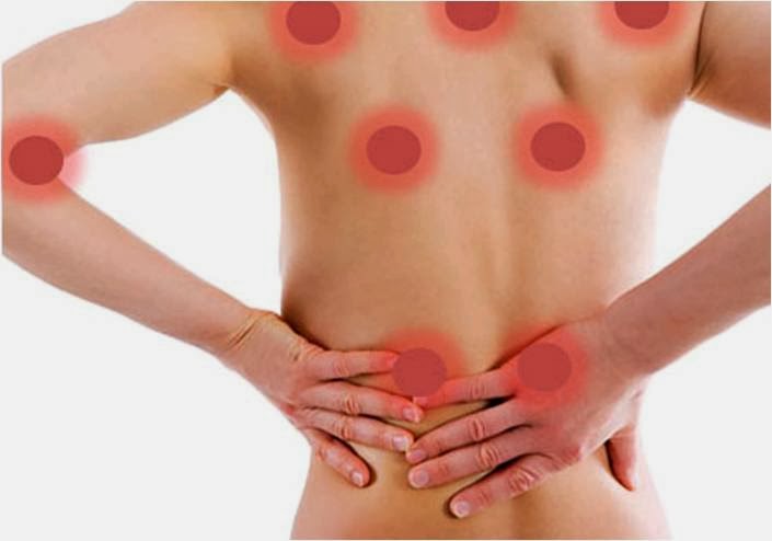 Cuáles son los síntomas de la fibromialgia?