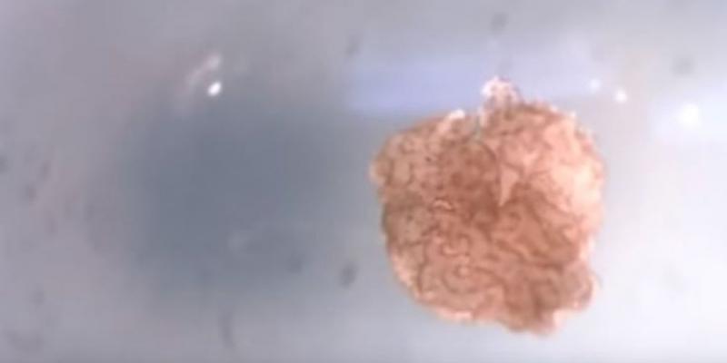 Así son los biobots, los primeros robots que nos obligarán a repensar las definiciones de vida y máquina Así son los biobots, los primeros robots que nos obligarán a repensar las definiciones de vida y máquina