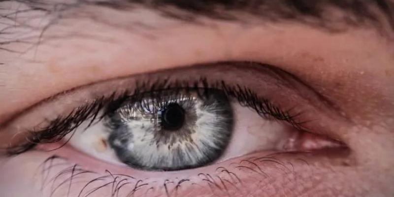 Ojo Ojo