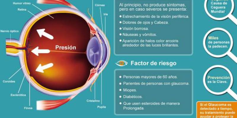 Fuente: "Cuida tu visión" Desarrollo del glaucoma y prevención del mismo