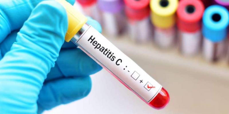 Hepatitis C