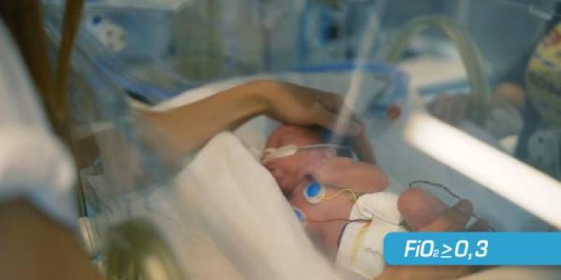 Podcast / Chiesi niños prematuros Niños prematuros en una incubadora
