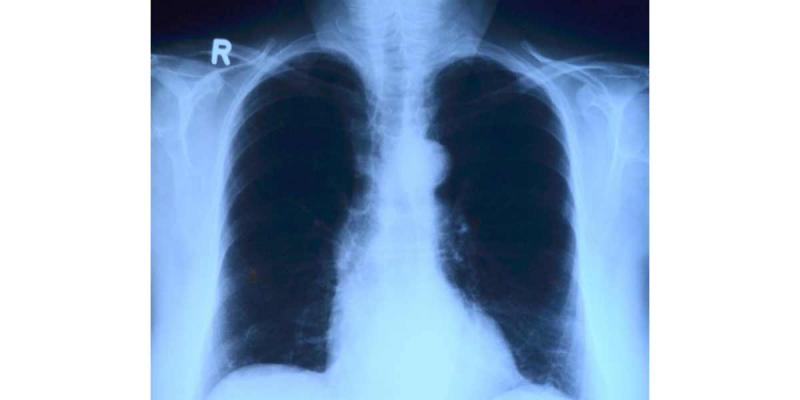 Elsevier Radiografía de Torax