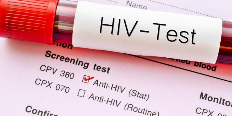 La mitad de los nuevos diagnósticos de VIH son tardíos, según los médicos. Sida VIH