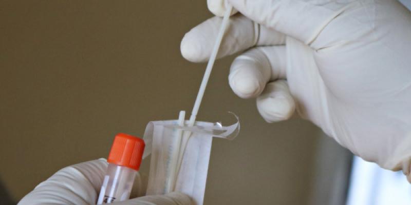 Los nuevos tests PCR detectan tanto Covid como ébola