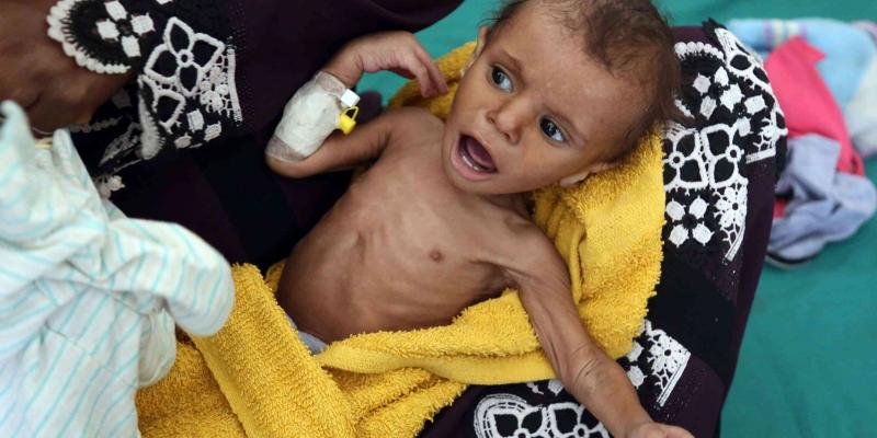 Desde 2015 han muerto 85.000 niños en Yemen por hambre y enfermedades Foto: AFP Yemen hambre niños