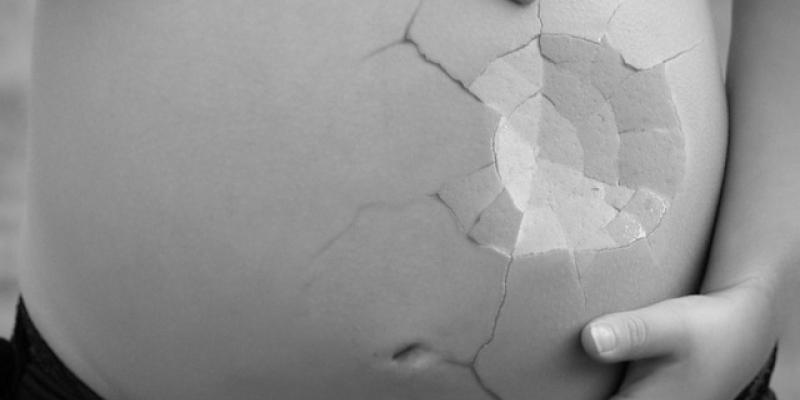Imagen de una tripa de embarazada rota / Pixabay Imagen de una tripa de embarazada rota