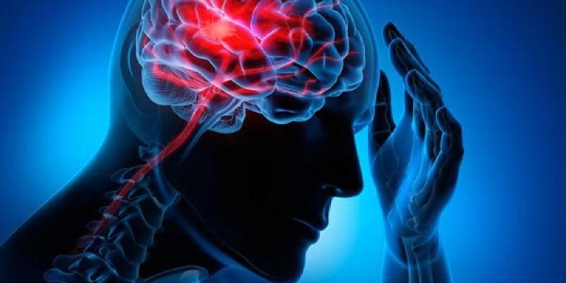 Accidentes cerebrovasculares Accidentes cerebrovasculares