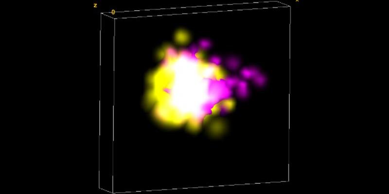 Reconstrucción en 3D de imágenes de microscopia de la proteína Tau 