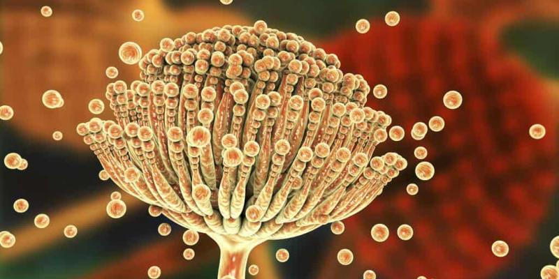 Imagen de la infección Aspergillus/MedlinePlus Amenazas de hongos y enfermedades pulmonares