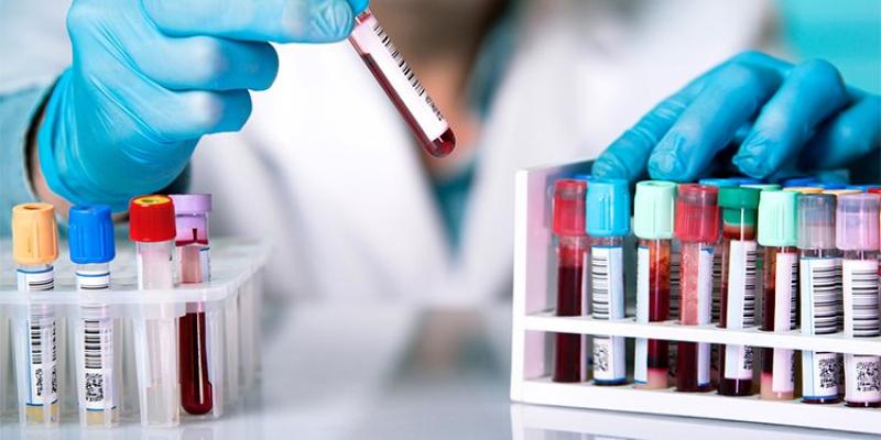 Un análisis de sangre predice si un paciente con esclerosis empeorará. Un análisis de sangre predice qué paciente con esclerosis múltiple empeorará.