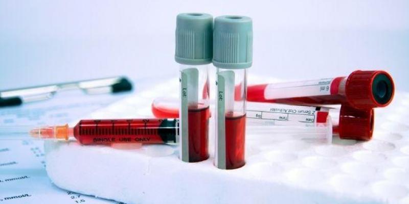 Tubos de análisis de sangre
