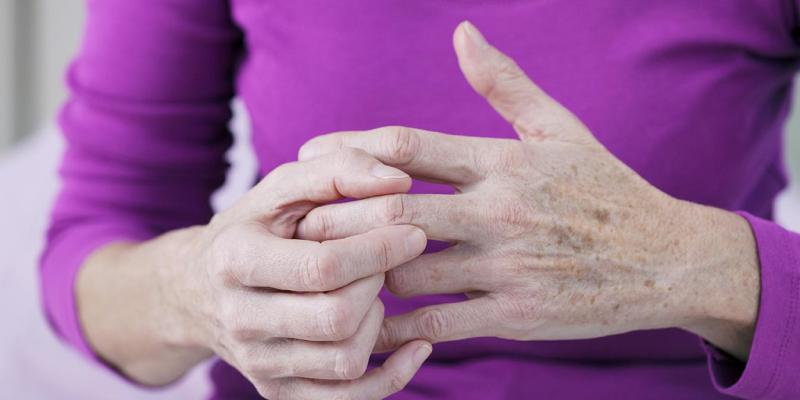 Fuente: https://hospital.vallhebron.com/es/asistencia/enfermedades/artrosis Manos de una mujer con artrosis