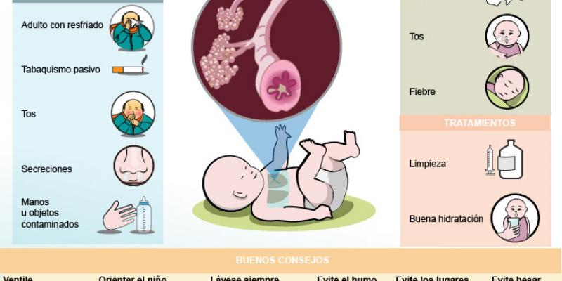 bronquiolitis