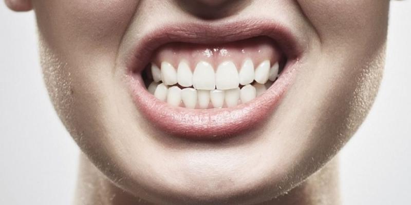 Imagen de una persona haciendo la acción del bruxismo/Dentalnova Estrés y bruxismo: ¿Qué es?