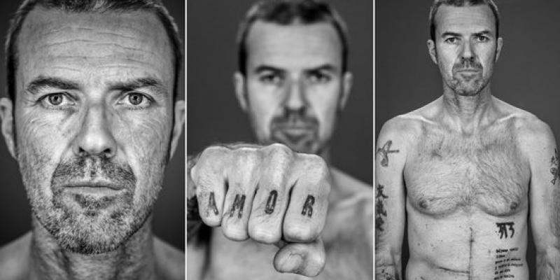 Pau Donés, cantante de Jarabe de Palo Síntomas y prevención del cáncer de colon, la enfermedad por la que ha fallecido Pau Donés