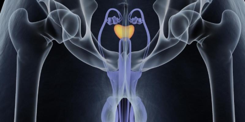 Investigación sobre la supervivencia al cáncer de próstata