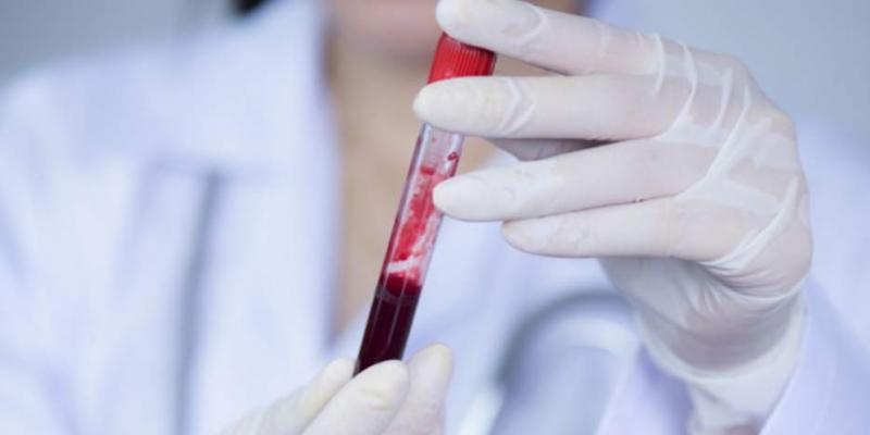 Muestra de plasma sanguíneo (Foto. Freepik)