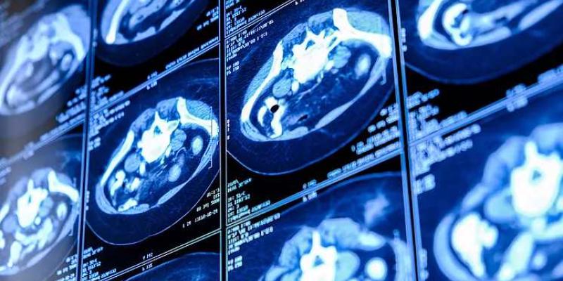 Cassandra: programa piloto para detectar enfermedades respiratorias / 20 Minutos Imagen de un escáner