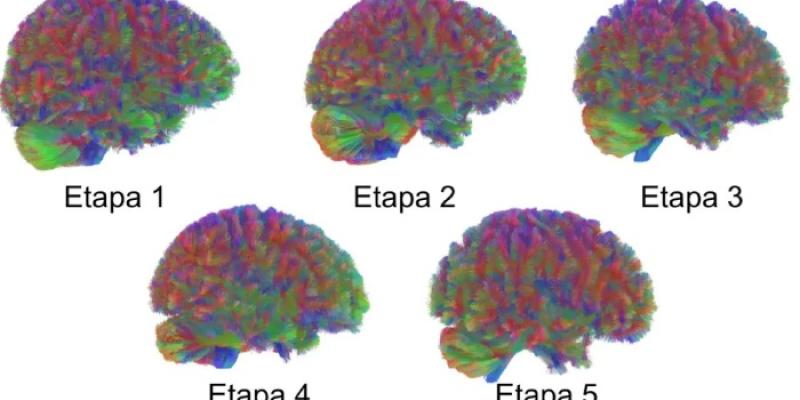  etapas del cerebro humano