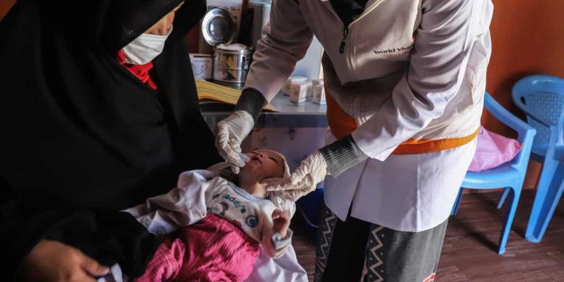Imagen de un niño desnutrido/World Vision Los conflictos bélicos dan lugar al hambre