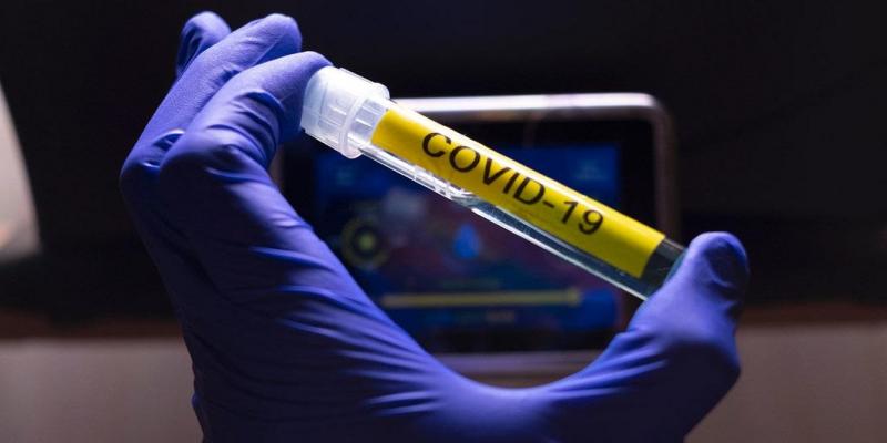 CORONAVIRUS. EUROPA PRESS Catorce millones de casos de COVID-19 en todo el mundo / Última Hora