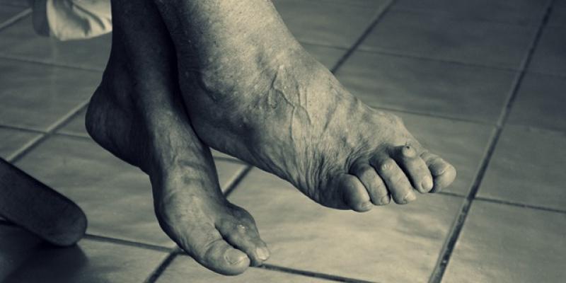 Pies de una persona mayor, demencia / Pixabay Pies de una persona mayor