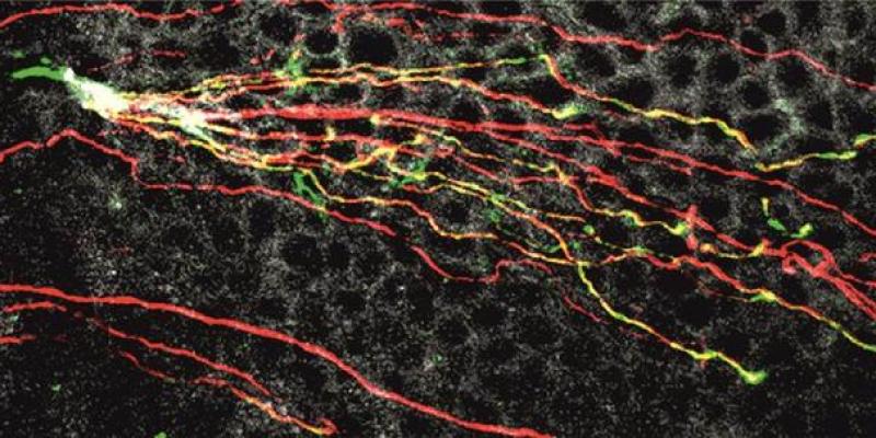 Fibras nerviosas de la córnea de ratón obtenidas mediante microscopía confocal 