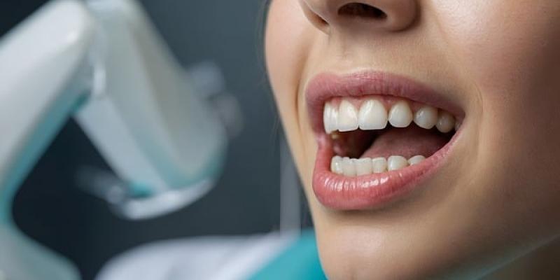 Dentista / Pixabay Boda de una persona