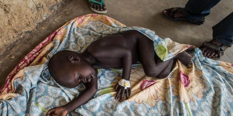 La desnutrición aguda severa y la hambruna aumenta en los países menos desarrollados