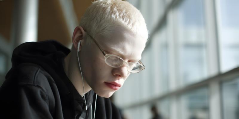 Joven estudiante con albinismo y gafas para corrección de la vista 