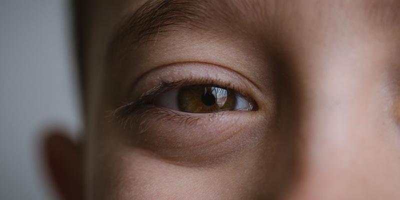 Discapacidades oculares / Pixabay Ojos de una persona con discapacidad ocular