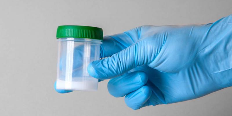 ¿Cuánto pagan por ser donante de semen? Donación de semen: Cuánto pagan, cómo se hace y dónde.