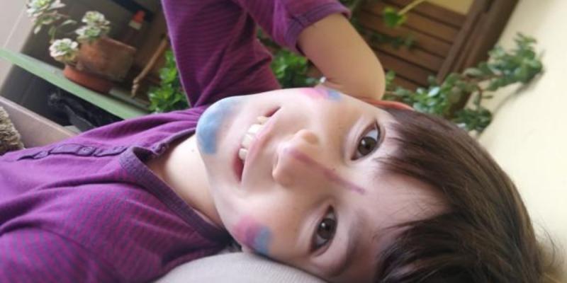 Nico, un niño con una enfermedad rara, necesita 126.000 euros para la investigación de su tratamiento Un niño de 10 años con una enfermedad rara, necesita 126.000 euros para la investigación de su tratamiento