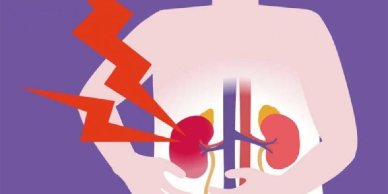 Ilustracion de un paciente con enfermedad renal