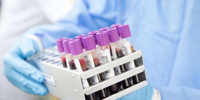 Imagen de pruebas de sangre/iSanidad Un test de sangre que predice varias enfermedades