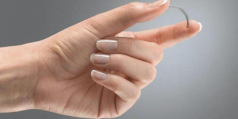 Imagen de un anticonceptivo/El Mundo Essure, el anticonceptivo más preocupante