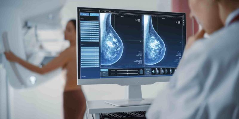 Imagen de una chica realizándose una mamografía/Revista Ginecológica y Obstetricia Las mamografías aumentan el riesgo de falso positivo en cáncer de mama