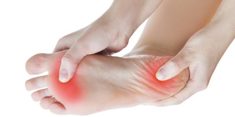 Fascitis plantar / Pixabay Pie con fascitis plantar