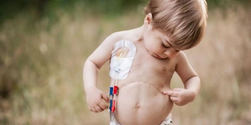El gen NEK8 y sus efectos - Sara Fonseca (Servimedia) Mateo, el niño con el gen NEK8