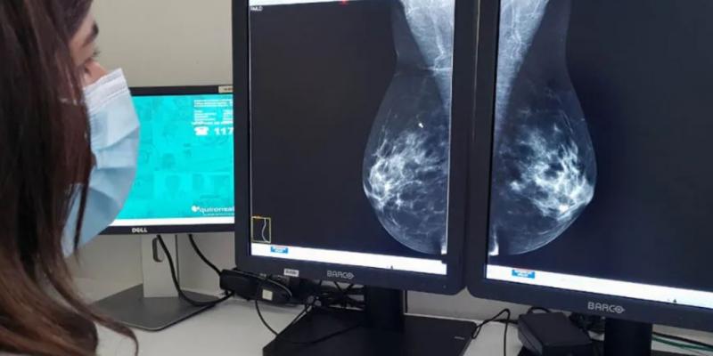 Imagen de una sanitaria observando una mamografía / Europa Press