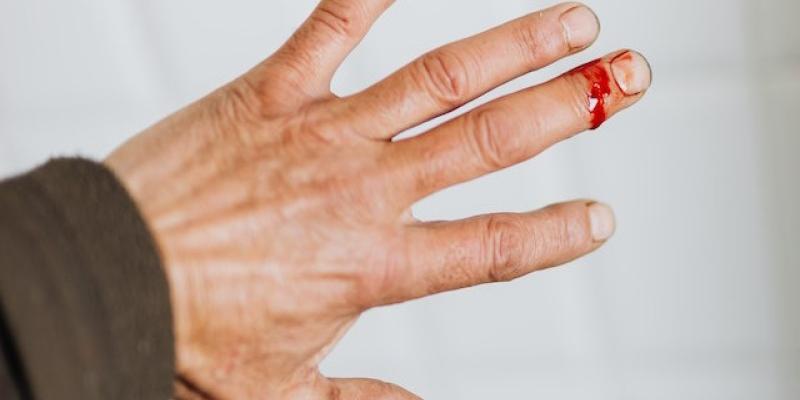 La hematofobia y el miedo a la sangre - Pexels Así funciona la hematofobia