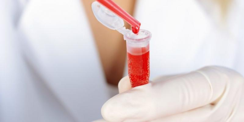 La Fedhemo cumple 50 años de trabajo por los derechos de las personas con hemofilia y otras coagulopatías Federación Española de Hemofilia celebra su 50 aniversario