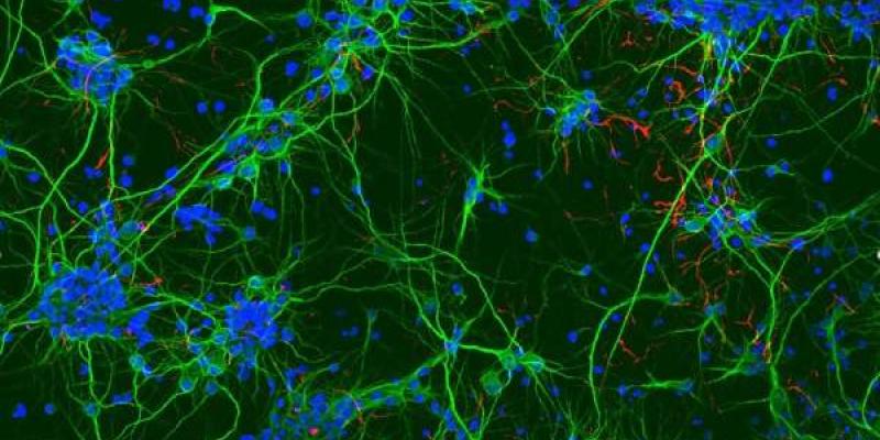 Lesiones medulares