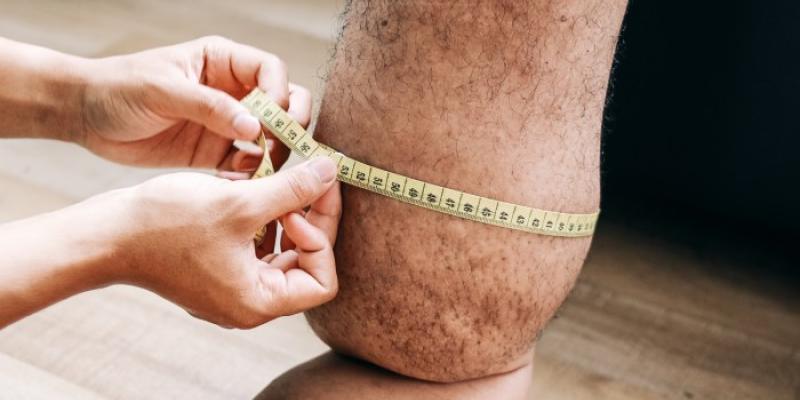Chequeo médico para la filariasis - Foto: Envato Elements Chequeo médico para la filariasis
