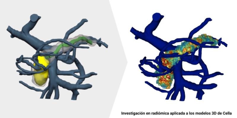 Tumores de pancreas - Envato Elements Investigación aplicada a modelos 3D