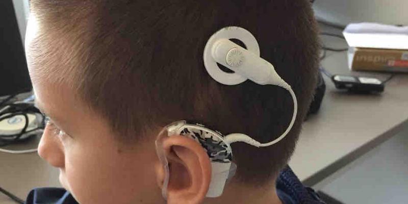 El PSOE ha presentado en el Congreso una proposición no de ley para mejorar la atención que reciben los niños con discapacidad auditiva