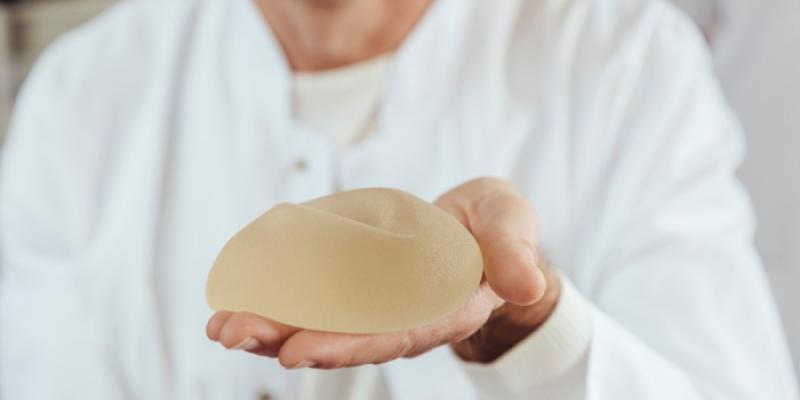 Implantes mamarios - Foto: Envato Elements Doctor sujetando un implante mamario